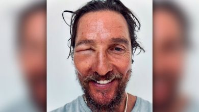 Matthew McConaughey Bee Sting: Is His Eye Okay?