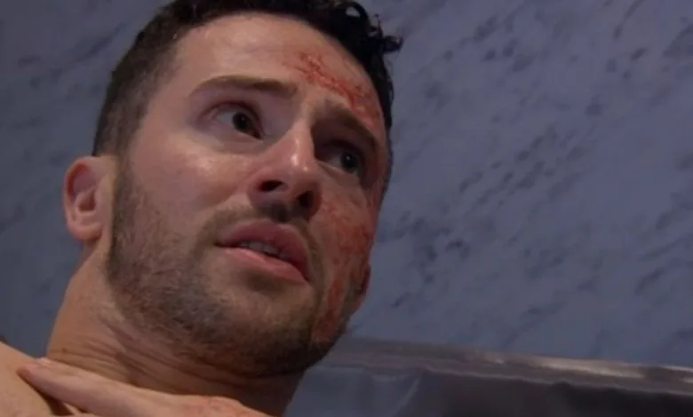 Emmerdale: Why Did Michael Parr Leave & When Will Ross Barton Return?